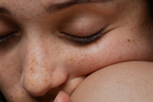 teint terne que faire eclat peau