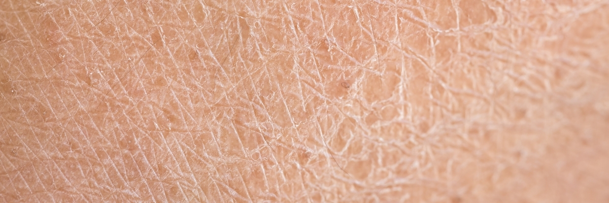 bienfaits visage huile de prune (3)
